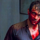 Hugh Dancy, in a convenient illustration of his show’s cancellation.